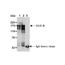 Enzo ADI-CSA-330-E EGF receptor monoclonal antibody (6F1) (100 µg)