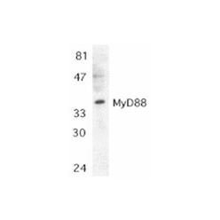 Enzo ADI-CSA-510-E MyD88 polyclonal antibody (100 µg)