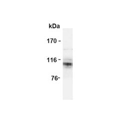 Enzo ADI-NBA-100-E APP monoclonal antibody (3E9) (100 µg)