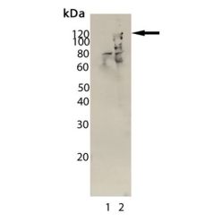 Enzo ADI-OSA-602-E HIF-1α monoclonal antibody (Hα111a) (100 µg)