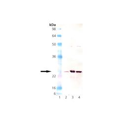 Enzo ADI-SOD-110-D Mn SOD polyclonal antibody (50 µg)