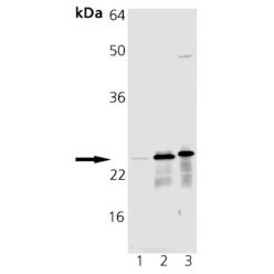 Enzo ADI-SOD-111-F Mn SOD polyclonal antibody (200 µg)