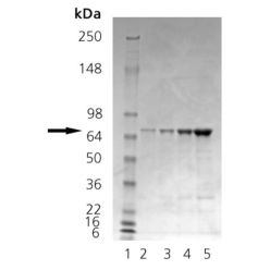 Enzo ADI-SPP-865-D Calnexin (lumenal domain) (human), (recombinant) (50 µg)