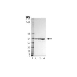 Enzo ADI-SRP-1510-F HOP (human), (recombinant) (200 µg)