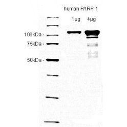 Enzo ALX-201-063-C020 PARP-1 (human), (recombinant) (high purity) (20 µg)