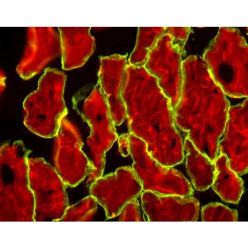 Vector Labs BMK-2202 M.O.M.® (Mouse on Mouse) Immunodetection Kit, Basic, 1 Kit (1/EA)