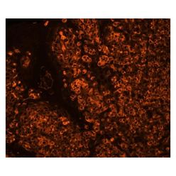 Vector Labs CL-1303-1 Sambucus Nigra Lectin (SNA, EBL), CY3, 1 mg (1/EA)