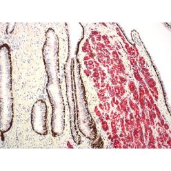 Enzo ENZ-ABS717-0010 P504S + p63 + HMWCK antibody cocktail (10 ml)