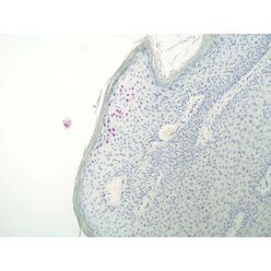 Enzo ENZ-GEN112-6000 DIGX® HPV type 6/11 probe (6 ml)