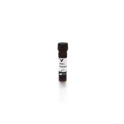 Vector Labs FL-1061-2 Ulex Europaeus Agglutinin I (UEA I), Fluorescein, 2 mg (1/EA)