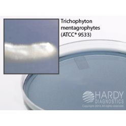 Hardy Diagnostic G01 Dry Culture Media, YM-11 Agar Plate,  100 Day Shelf Life (Pack of 10)
