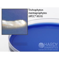 Hardy Diagnostic G265 Dry Culture Media, ETA w/ Antibiotics Plate,  70 Day Shelf Life (Pack of 10)