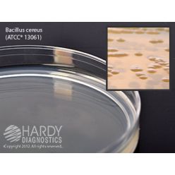 Hardy Diagnostic G294 Dry Culture Media, Starch Agar Plate,  90 Day Shelf Life (Pack of 10)