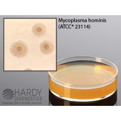Hardy Diagnostic G32 Dry Culture Media, SP4 Agar w/ Arginine Plate,  84 Day Shelf Life (Pack of 10)