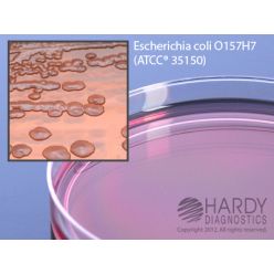 Hardy Diagnostic G36 Dry Culture Media, MacConkey Agar w/ Sorbitol Plate,  90 Day Shelf Life (Pack of 10)
