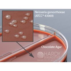 Hardy Diagnostic J72 Dry Culture Media, Chocolate/Mod.Thayr Martn Biplate,  70 Day Shelf Life (Pack of 10)
