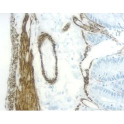 Vector Labs MP-7422-15 ImmPRESS®-HRP Horse Anti-Mouse IgG, Rat adsorbed Polymer Detection Kit, Peroxidase, 15 ml (1/EA)