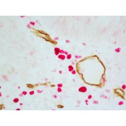 Vector Labs MP-7714-15 ImmPRESS® Duet Double Staining HRP/AP Polymer Kit (Anti-Rabbit IgG-brown, Anti-Mouse IgG-magenta), 1 Kit (1/EA)