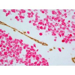 Vector Labs MP-7724-15 ImmPRESS® Duet Double Staining HRP/AP Polymer Kit (Anti-Mouse IgG-brown, Anti-Rabbit IgG-magenta), 1 Kit (1/EA)