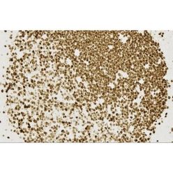 Vector Labs MP-7802-15 ImmPRESS®-HRP Horse Anti-Mouse IgG PLUS Polymer Kit, Peroxidase, 1 Kit (1/EA)