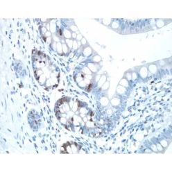 Vector Labs PK-6101 VECTASTAIN® Elite ABC-HRP Kit, Peroxidase (Rabbit IgG), 1 Kit (1/EA)