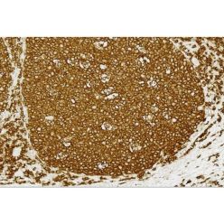 Vector Labs PK-8200 VECTASTAIN® Elite® ABC Universal PLUS Kit, Peroxidase (Horse Anti-Mouse/Rabbit IgG), 1 Kit (1/EA)