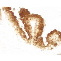 Vector Labs SK-4100 DAB Substrate Kit, Peroxidase (HRP), with Nickel, (3,3'-diaminobenzidine), 1 Kit (1/EA)