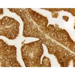 Vector Labs SK-4105 ImmPACT® DAB Substrate, Peroxidase (HRP), 120 ml (1/EA)