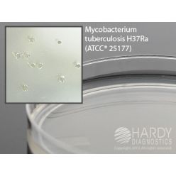 Hardy Diagnostic W35 Dry Culture Media, Middlebrook 7H11 Plate,  120 Day Shelf Life (Pack of 10)